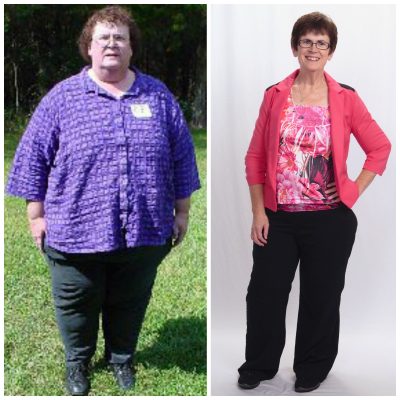Teresa Parker on left in 2004 at 430 pounds. Today, she has lost more than 250 pounds and she's still planning on losing more.