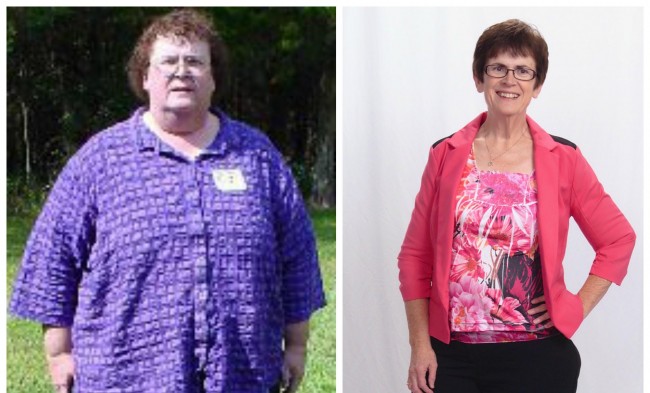 before-after wl half