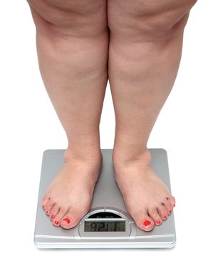 women legs with overweight