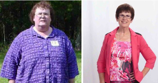 before-after wl copy HALF