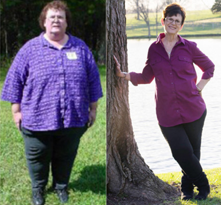 before-after 2015
