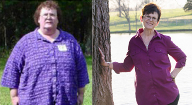 before-after 2015 half