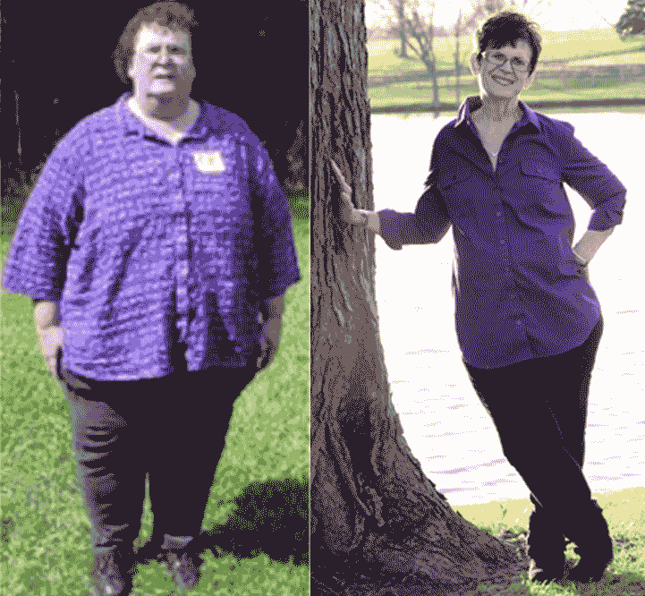 before-after-2015-8